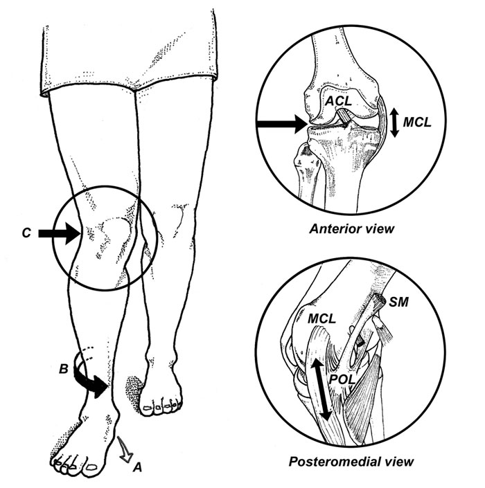 Image result for rearfoot pronation