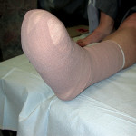 Figure 4c: Football Dressing Coban Wrap