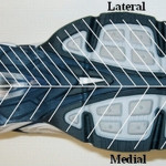 Figure 2: Depiction of the difference in stiffness between the lateral (stiffer) and medial (less stiff) aspects of the variable-stiffness intervention shoe sole.