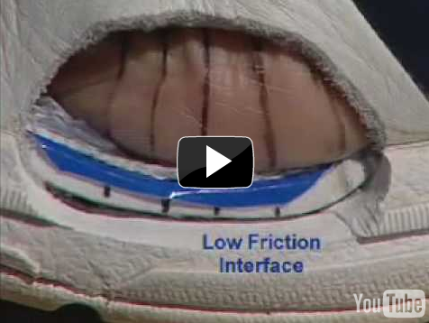 Douglas H. Richie Jr., DPM: Richie Ulcer Guard