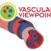 VASCULAR VIEWPOINT: Compression therapy and the DVT epidemic