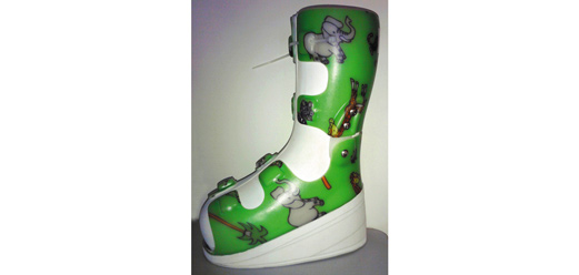 Achilles Contracture Management Orthosis