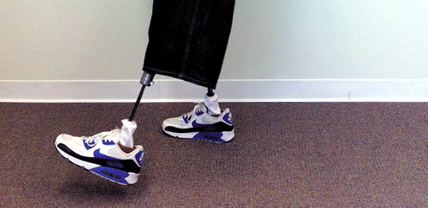 Mysteries of O&P devices and energy expenditure