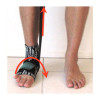 Foot/Ankle E-Module 