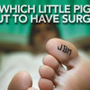 Preventing wrong-site foot and ankle surgery