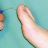 Monofilament testing withstands critiques