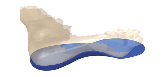 OrthoModel Design Software