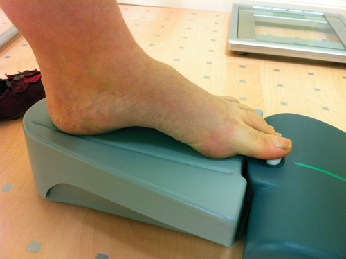 Idiopathic toe walking: Insights on 