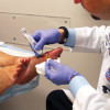 Despite few solid studies, ulcer debridement thrives
