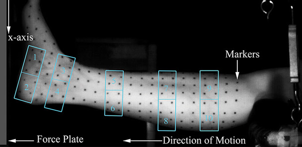 Soft tissue composition and bone injury risk