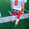 Fear fallout: Studies explore effects on ACL outcomes 
