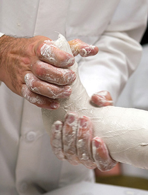 Plaster outranks other pediatric casting materials for moldability