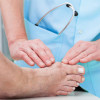 Correcting hallux valgus