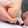 Debating corticosteroid injections for heel pain