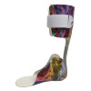 Prepreg Ankle Foot Orthosis