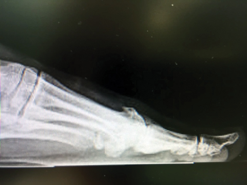 Figure 1. X-ray of an arthritic joint.