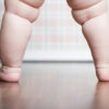 Excess weight affects foot loading, peak pressure even in young kids    