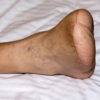 People with Diabetes Foot Complications Do Not Recall Their Education: A Cohort Study
