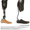 Crossover prosthetic design