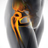 Gait therapy in osteoarthritis of the hip: An assessment