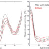 Foot Type Determines Effect of Orthotics on Muscle Activity