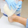Advancements in Wound Healing Management