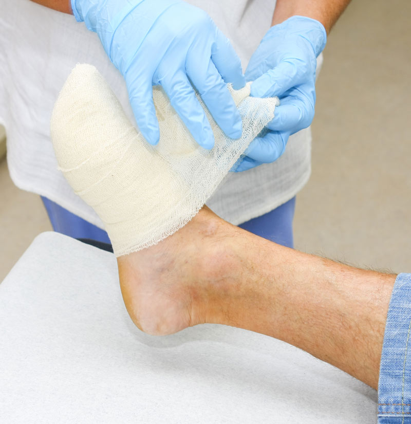 Pick Up The Pace: Tips For Optimizing How Quickly A Wound Heals - Sanara  MedTech