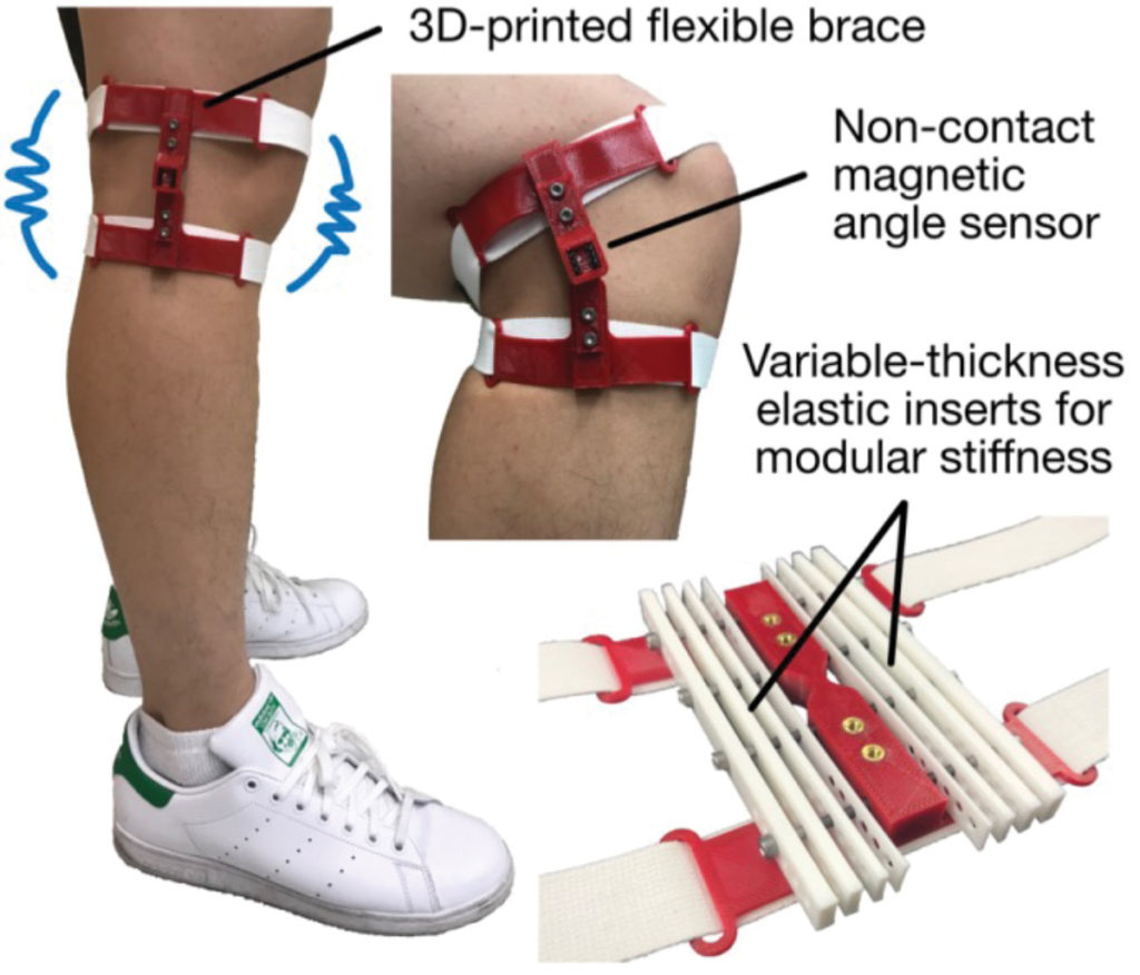 3D-Printed Knee Brace To Aid Rehab, Elderly | Lower Extremity Review ...