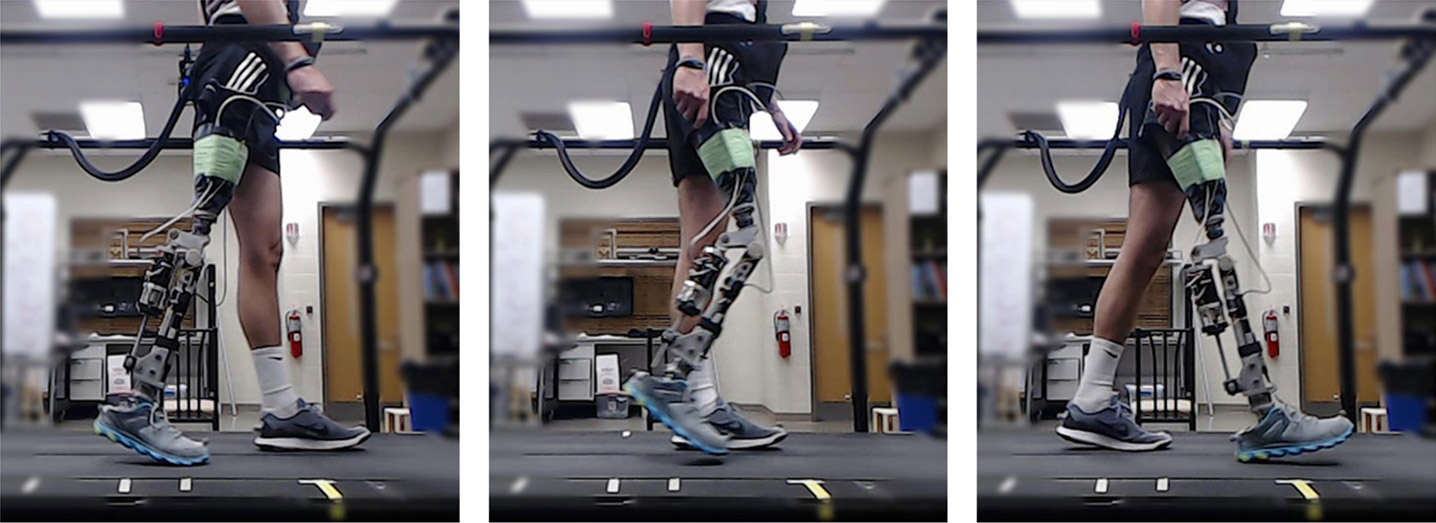 Reinforcement Learning Expedites Tuning of Robotic Prostheses
