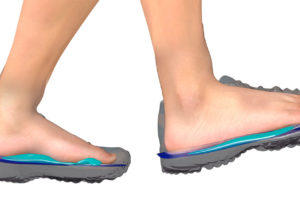 Edensoles with Dynamic Customization Technology