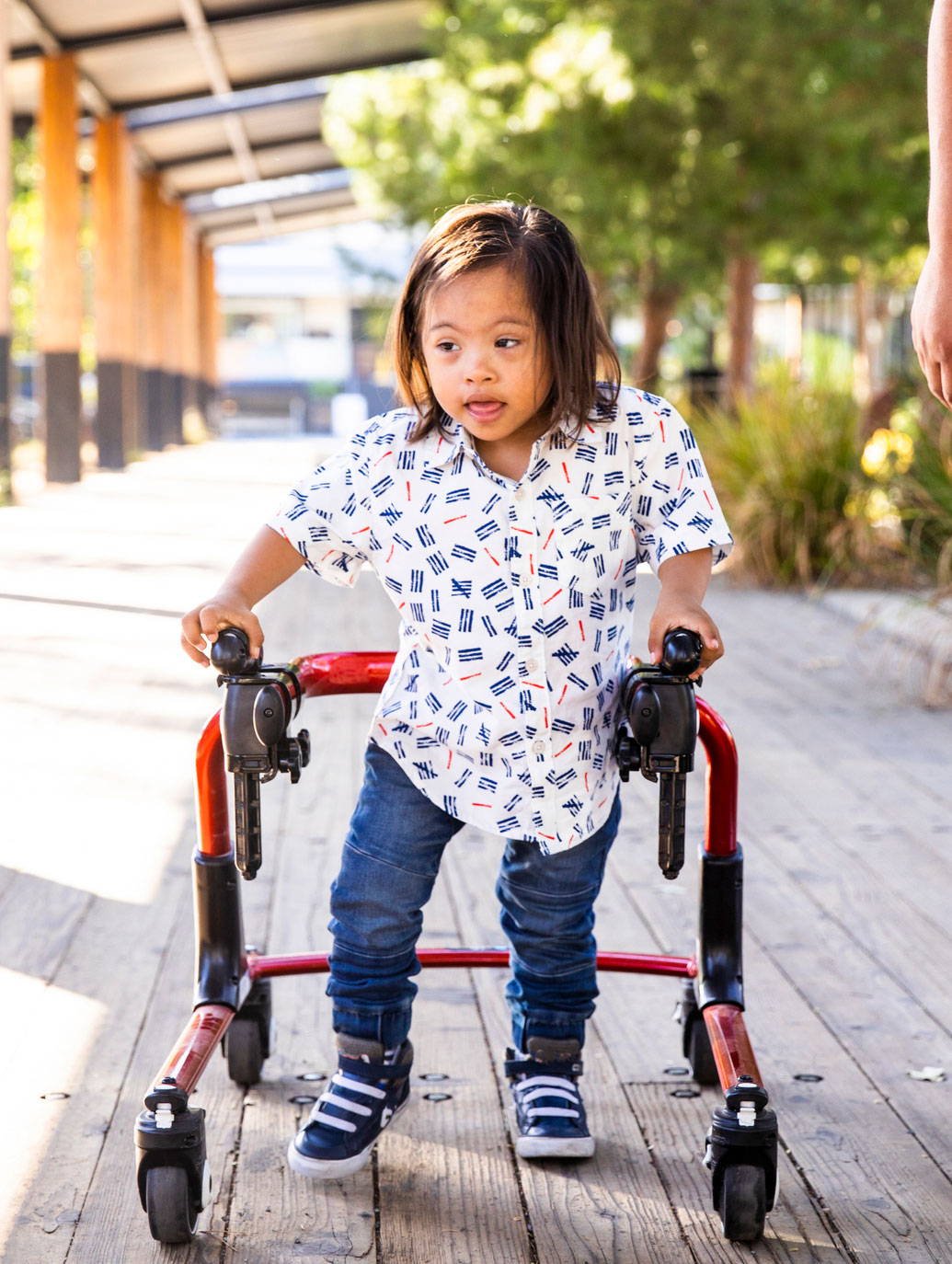 Early Orthotic Intervention in Pediatric Patients, Part 2: Down Syndrome, other neurological conditions, and toe walking