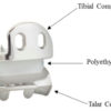 Ankle Replacement System Receives FDA Premarket Approval