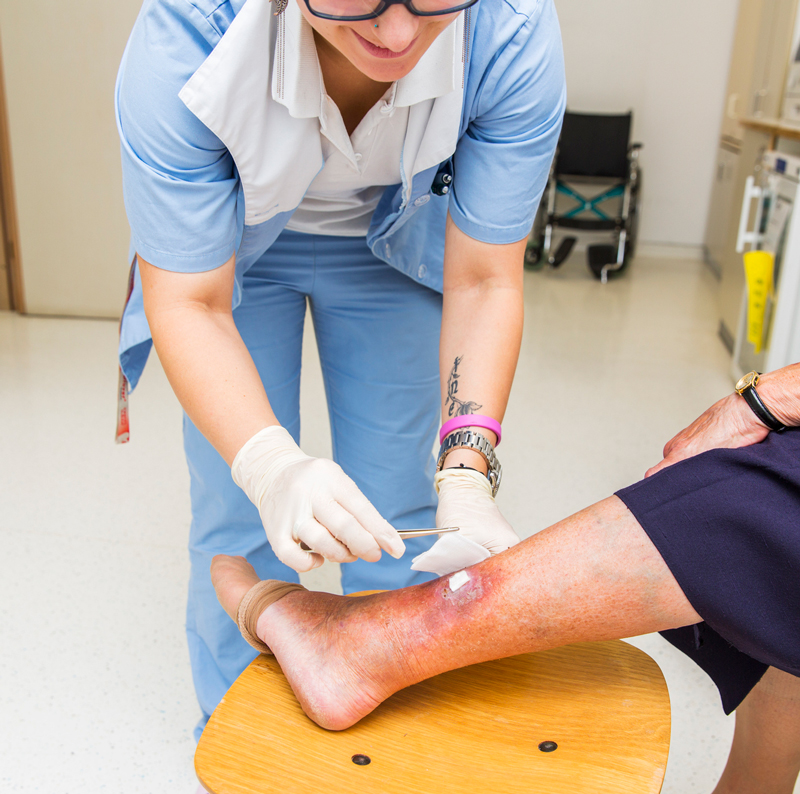 Study Examines Treatment of Chronic Wound Pain with Long-Acting Lidocaine Gel
