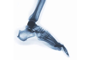 DDR: X-ray that Moves