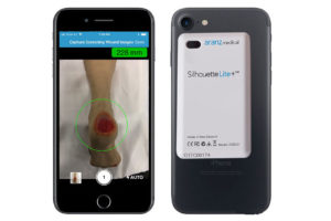 SilhouetteLite+ by ARANZ Medical