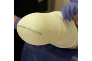 STS Company Rigid Dressing Sock