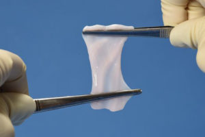 Cryo-Cord Umbilical Cord Graft Material