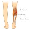 Predicting Return-to-Play After Calf Muscle Strain Injury