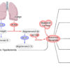 A mechanistic model and therapeutic interventions for COVID-19 involving a RAS-mediated bradykinin storm