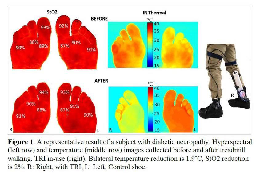 UT SOUTHWESTERN SCIENTISTS DEVELOP COOLING INSOLE