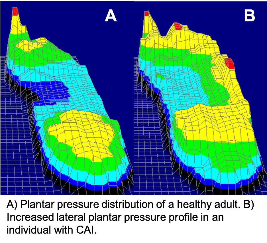 Biomechanics Basics: The Challenges of Shifting Plantar Pressure