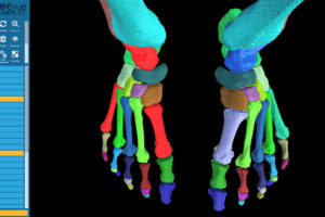 Platform for Complex Foot and Ankle Measurements