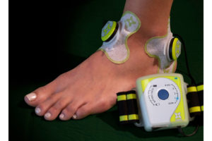 sam 2.0 Ultrasound Therapy