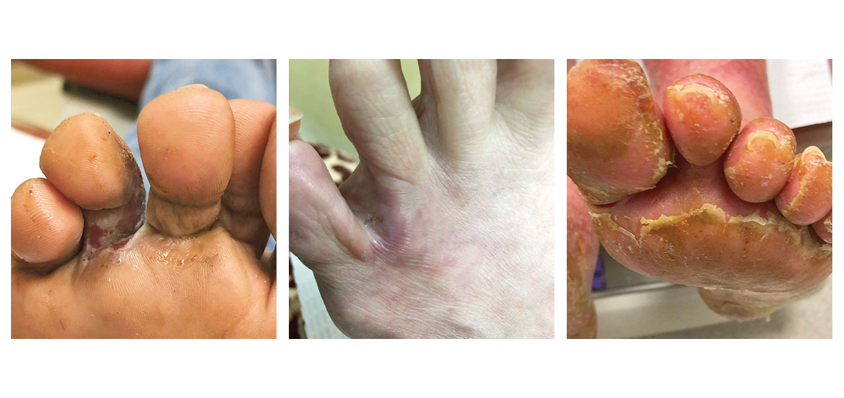 WEB SPACE INFECTION PCR TESTING