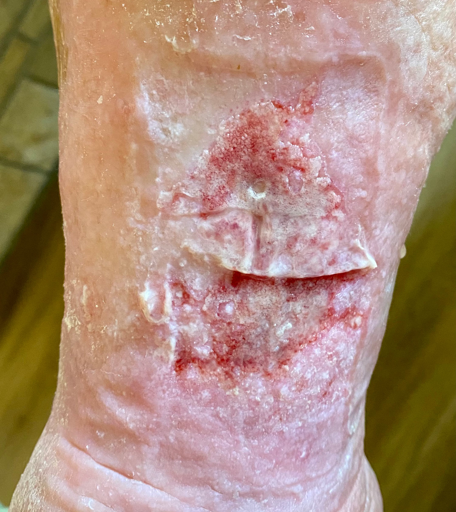 Atypical Wounds: What Every Clinician Should Know