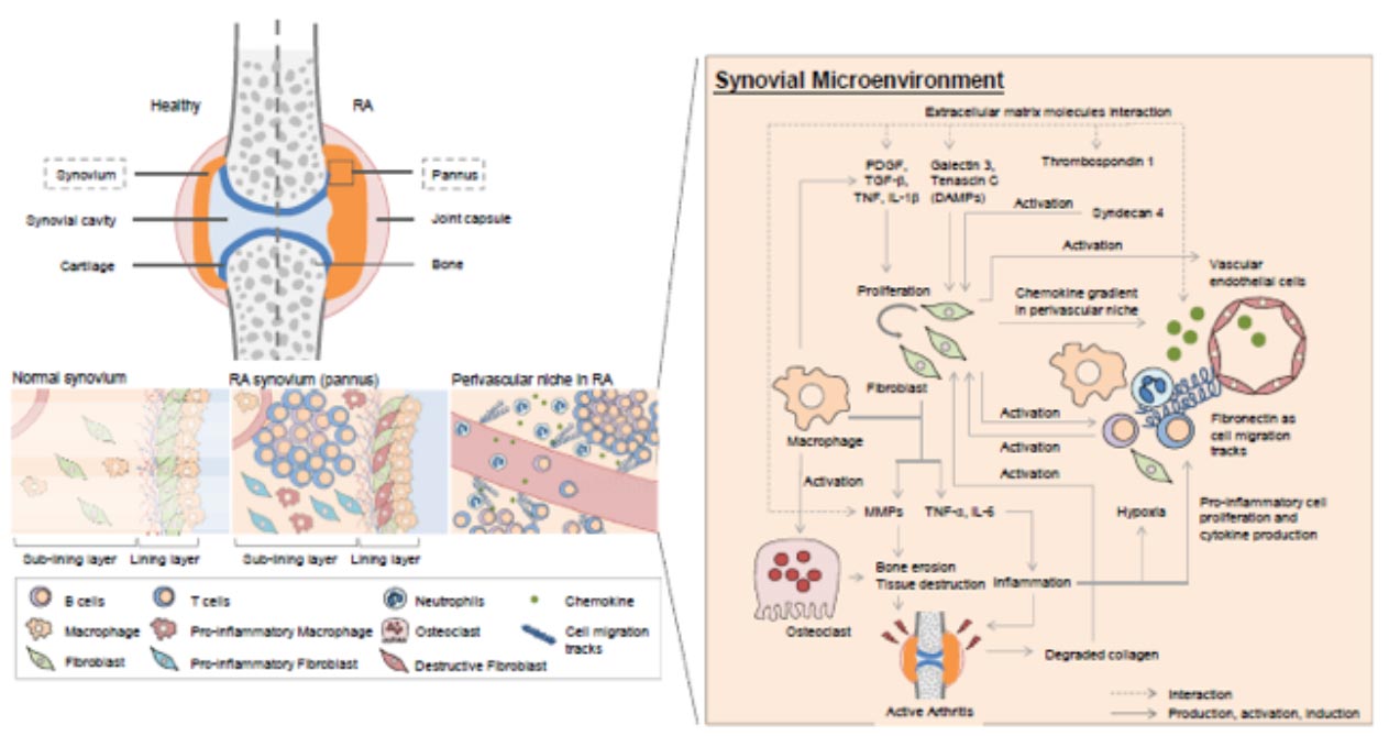 Tissue Microenvironment in Rheumatoid Arthritis