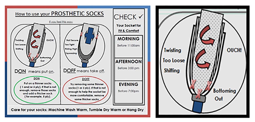 Solution to Prosthetic Socks Management