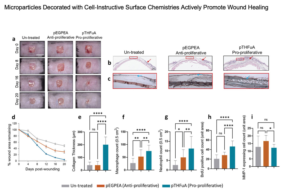 Newly Discovered Material Helps Diabetic Wounds Heal Quickly