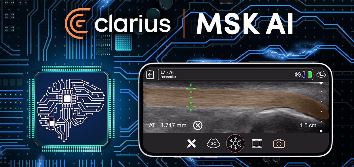 AI Ultrasound App for Musculoskeletal Imaging