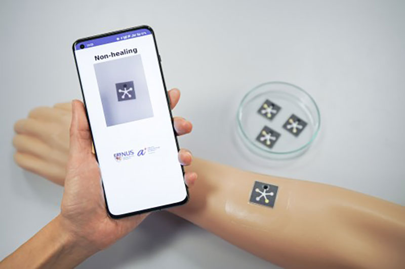 AI Sensor Monitors Chronic Wounds